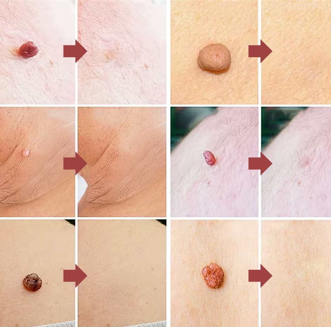 DermaPlasma für makellose Schönheit