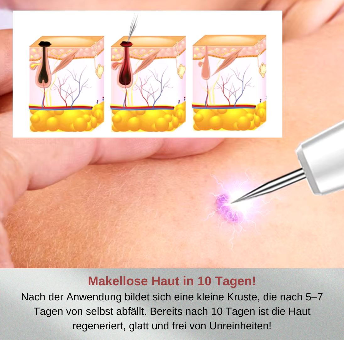DermaPlasma für makellose Schönheit