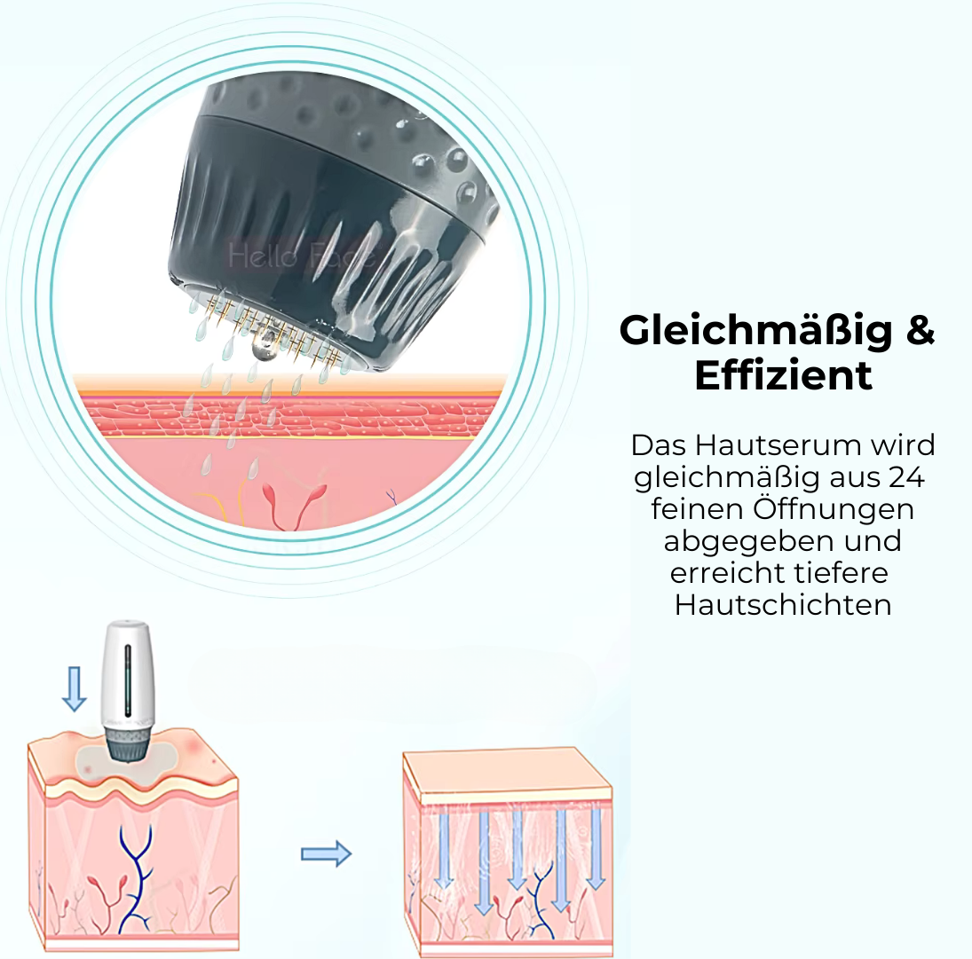DermaRoll Pro™️ - Die Kunst der Mikronadeln