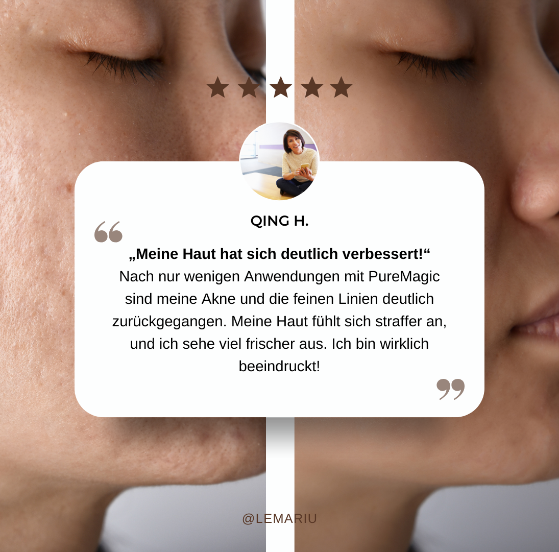 PureMagic - Magischer Stab für reine Haut