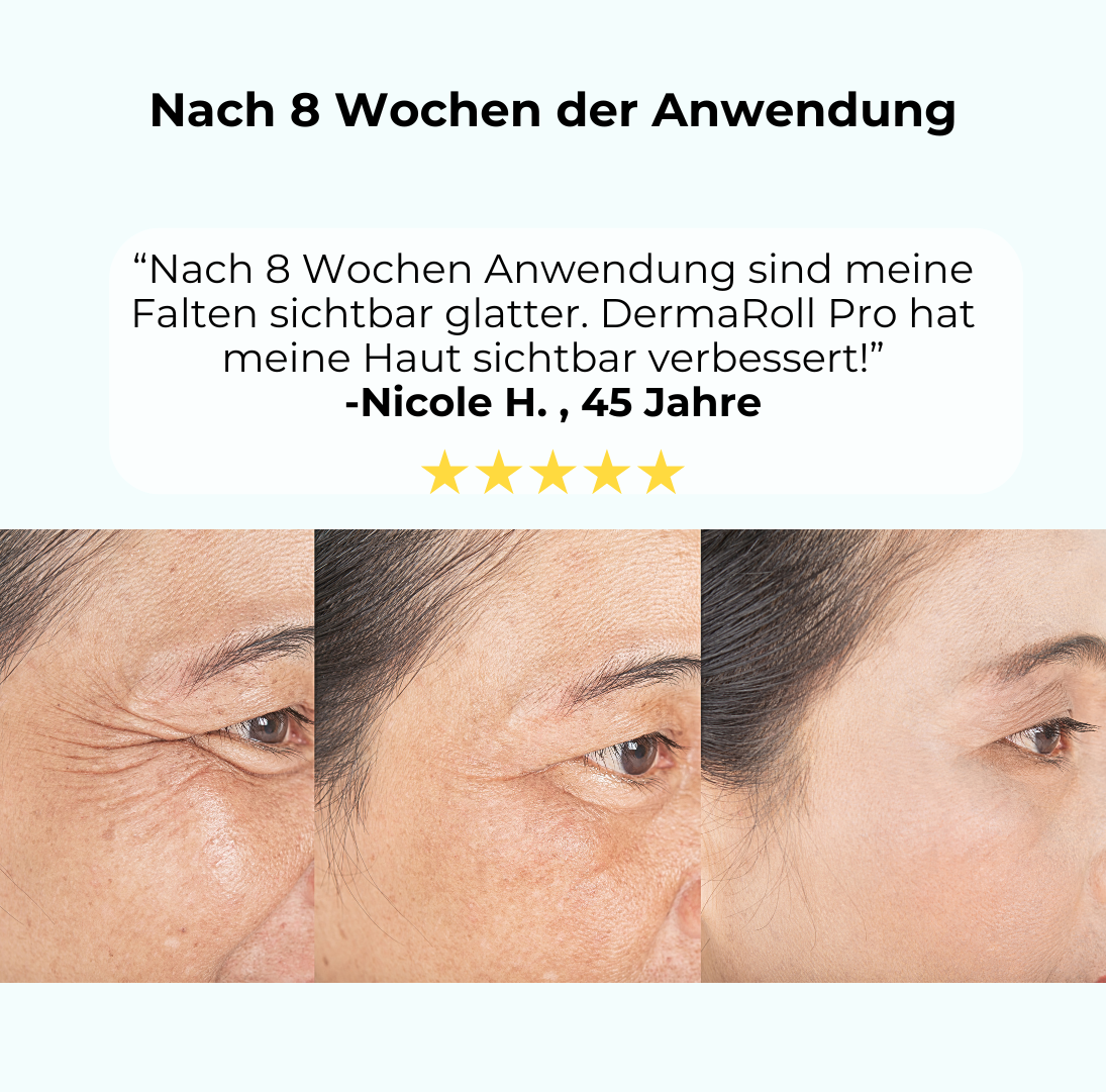 DermaRoll Pro™️ - Die Kunst der Mikronadeln