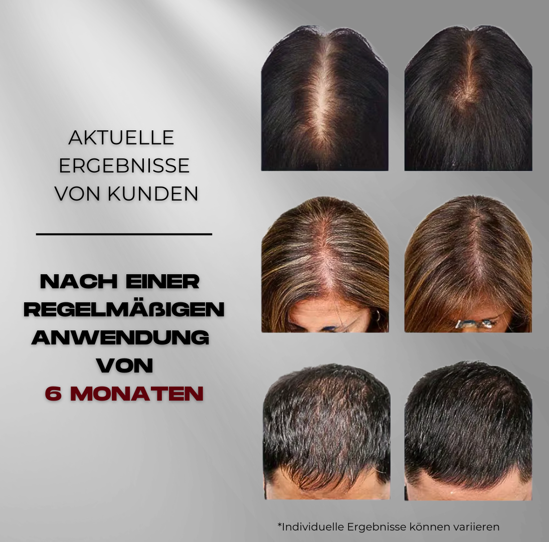 ReGrow Cap – Die Revolution gegen Haarverlust