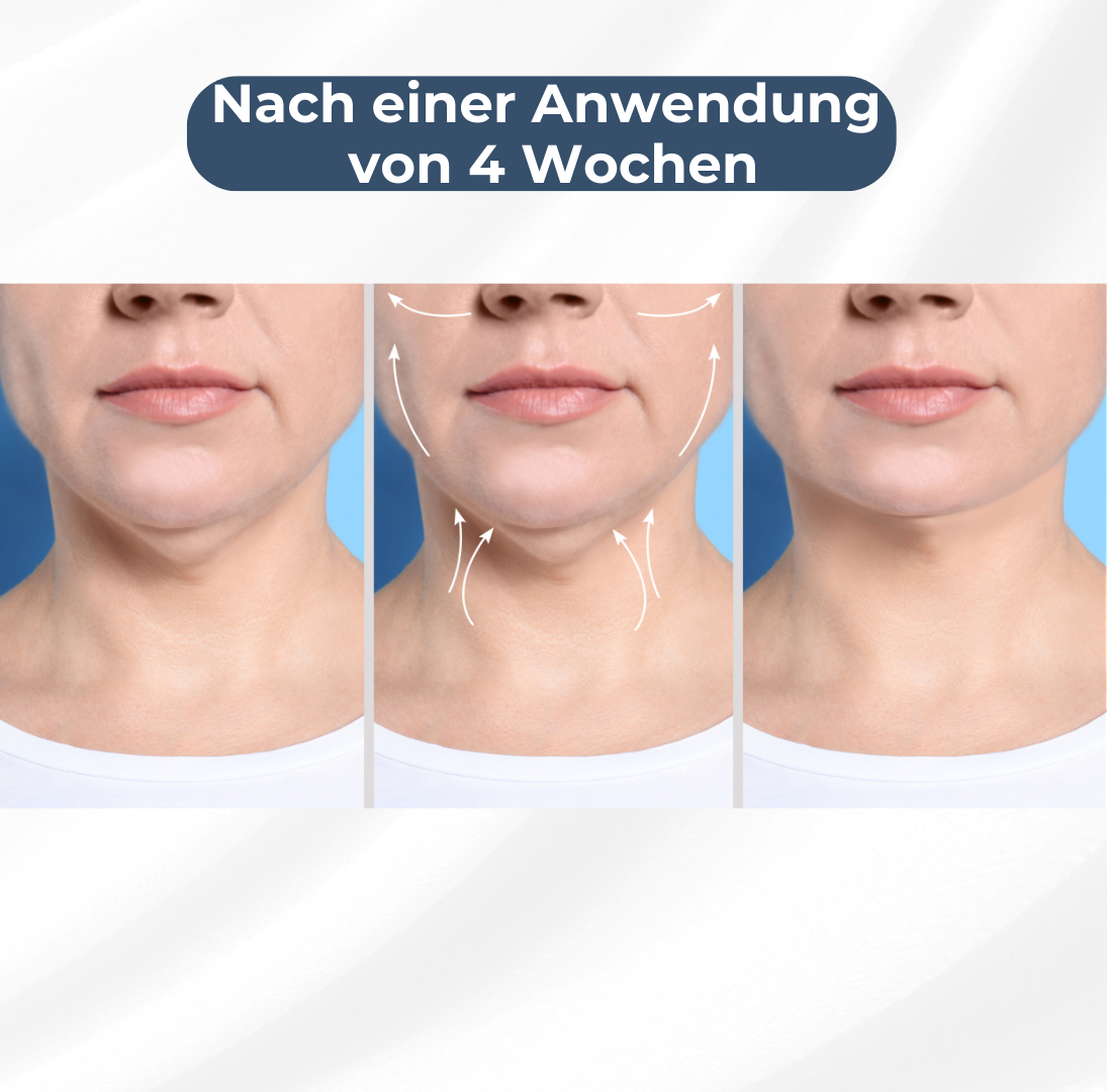 EMStone™️ – Die Revolution der Hautstraffung