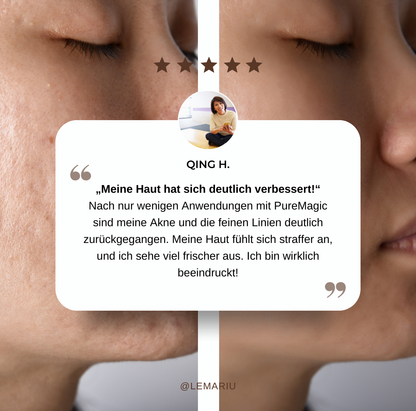 PureMagic - Magischer Stab für reine Haut