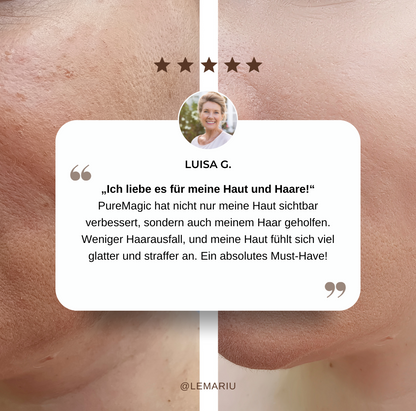 PureMagic - Magischer Stab für reine Haut